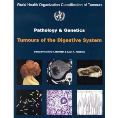 Image of Pathology and Genetics of Tumours the Digestive System (World Health Organization Classification S.)