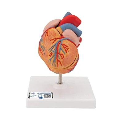 Image of 3B Scientific Human Anatomy Classic Heart Model with Left Ventricular Hypertrophy, 2 Part + free App Smart