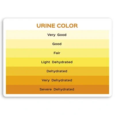 Image of 2 x 10cm Urine Color Vinyl Stickers Medical Nurse Doctor Health Sticker #30065 (10cm Wide)