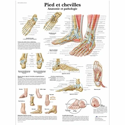 Image of 3B Scientific VR2176UU Anatomical Chart &quot;Pied et Chevilles Anatomie Pathologie&quot;, Paper Version