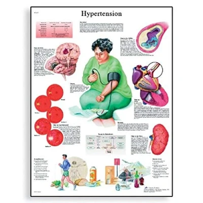 Image of 3B Scientific Human Anatomy Hypertension Chart, Paper Version