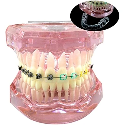 Image of Dental Orthodontic Demonstration Model,Dental Teeth Retainer Treatment Model with Metal Self ligating Brackets Explaining