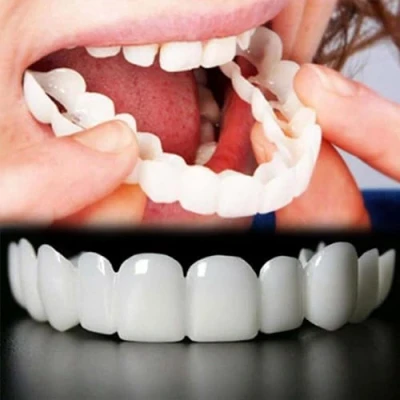 Image of False Teeth Veneers,2 Pairs Clip in Veneers UK, Instant on Snap Top and Bottom Dentures with Box for Men Women Regain Confident Smile