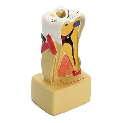 Image of brands Learning Resources Teaching Dental Disease Teeth Implantation Model Study