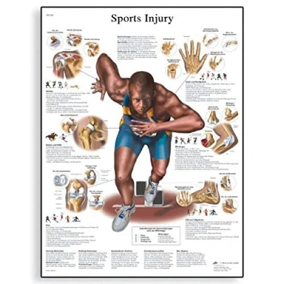 Image of 3B Scientific Human Anatomy Sports Injuries Chart, Paper Version, VR1188UU, unlaminated