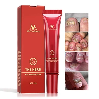Image of Herbal Foot Nail Cream, Protector Skin Care Cream Ointment Treatment Toe Onychomycosis Paronychia Anti Fungal Repair 15g
