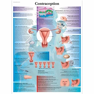 Image of 3B Scientific VR2591UU Anatomical Chart &quot;Contraception&quot;, Paper Version