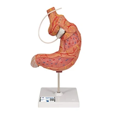 Image of 3B Scientific K15/1 Gastric Band Model + free Anatomy App Smart