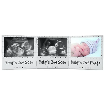 Image of New Baby Scan Frame Pregnancy Pregnant Ultrasound 12 20 Week First Photo Picture 3 in 1