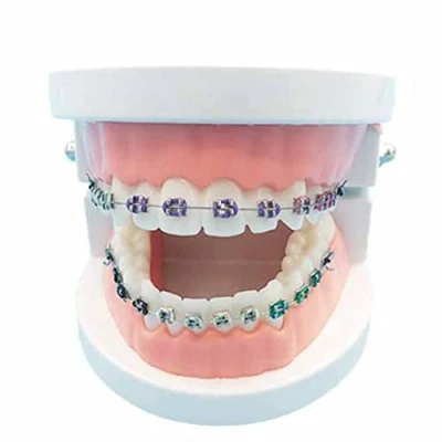 Image of Simulation Oral Tooth Model Dental Orthodontic Demonstration Teeth Treatment with Metal Bracket,Arch Wire Explaining Braces (C)