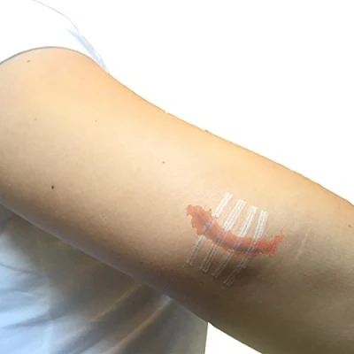 Image of PACK OF 10 STEROPLAST 3MM X 75MM WOUND CLOSURE ADHESIVE STERILE SUTURES SKIN STITCH STRIPS