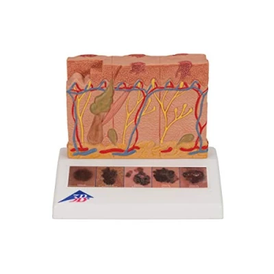 Image of 3B Scientific Skin Cancer Model + free Anatomy App Smart