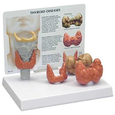 Image of 3B Scientific Thyroid Model