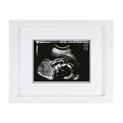 Image of Pearhead Sonogram Keepsake Frame, Mothering Sunday Mother&#039;s Day Expecting or New Mum Gift, White