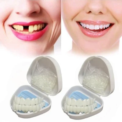Image of Flipped Warmth Upper &amp; Lower Teeth Veneers 2 Pairs Simulation Braces Snap on Smile Fake Cover Imperfect Perfect Whitening False One Size Dentures
