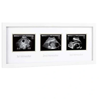 Image of Pearhead Triple Sonogram Pregnancy Frame, Baby Scan Photo Announcement, White