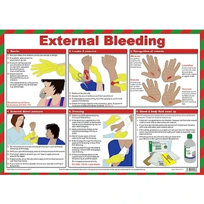 Image of Safety First Aid Group External Bleeding A2 Poster, Laminated