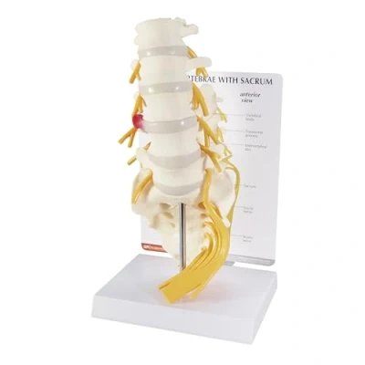 Image of 3B Scientific 5 Piece Vertebrae with Sacrum Model