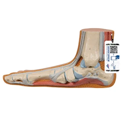 Image of 3B Scientific M31 Flat Foot, Pes Planus + free Anatomy App Smart