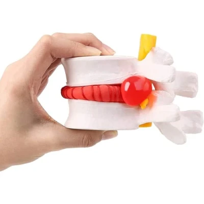 Image of LSOAARRT Human Lumbar Disc Herniation Demonstration Model of Vertebral Spine