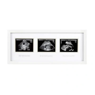 Image of Pearhead Trimester Sonogram Picture Frame, Pregnancy Photo Milestone Wall Decor, Ultrasound Keepsake, Gender Neutral Baby Nursery Décor, White
