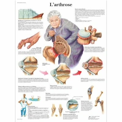 Image of 3B Scientific anatomical board, 1
