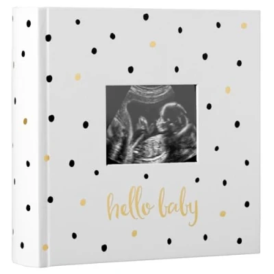 Image of Pearhead Baby Photo Album, Book Keepsake for New and Expecting Parents, Gender Neutral Accessory, Black Gold Polka Dot