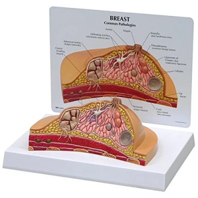 Image of 3B Scientific 1019559 Breast Cross Section Model