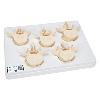 Image of 3B Scientific Set of 5 Lumbar Vertebrae + free Anatomy App Smart