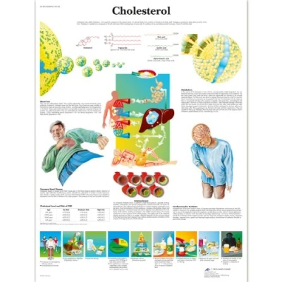 Image of 3B Scientific Human Anatomy Cholesterol Chart, Laminated Version