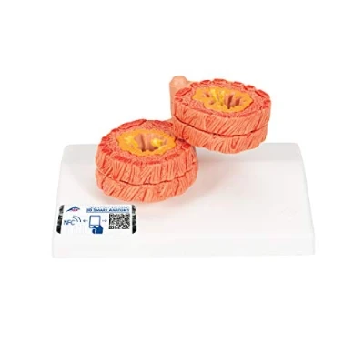 Image of 3B Scientific COPD Bronchial Tissue Model + free Anatomy App Smart